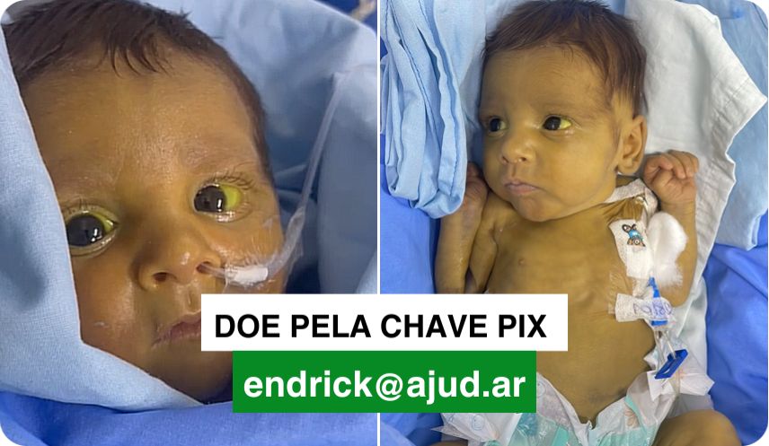 Banner Bebê de 2 meses com olhos e pele amarelados precisa de ajuda urgente. Sem tratamento, mãe teme pela vida do filho