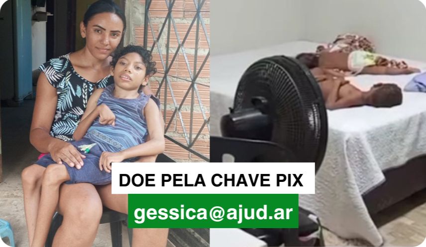 Sem leite especial no posto, mãe solo de 3 crianças dá mingau pra filho com sonda e microcefalia. Ele precisa ganhar peso pra operar escoliose