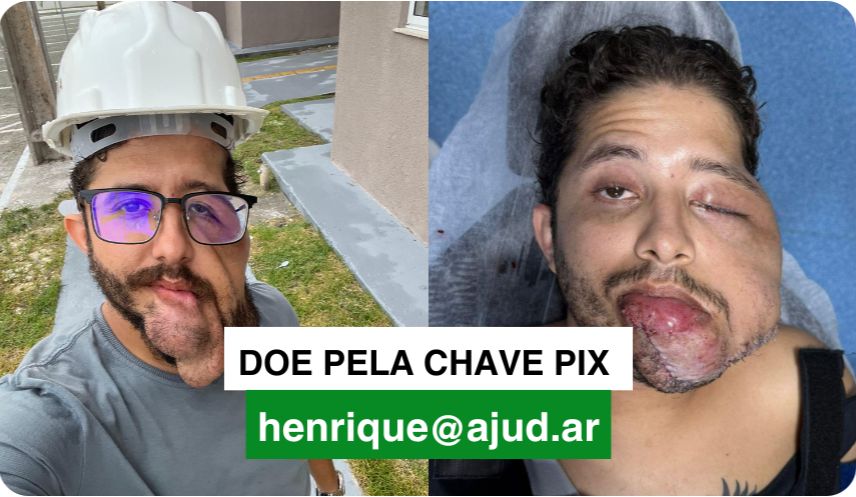 Banner Vaquinha para ajudar maranhense com tumores que deformam o seu rosto. Sofre preconceito e comentários maldosos nas redes