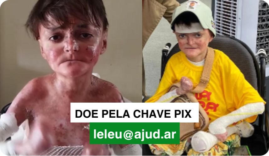 Leleu, que tem feridas em carne viva, vende bonés para comprar curativos: “Preciso deles pra não sentir dor”