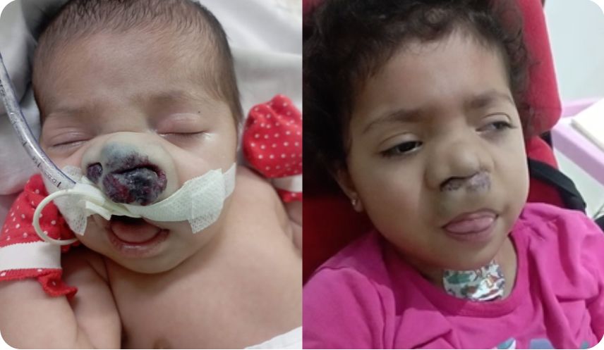 Banner Bebê pode morrer a qualquer momento por hemorragia extrema. Precisa de tratamento urgente, mas benefício foi negado 4 vezes
