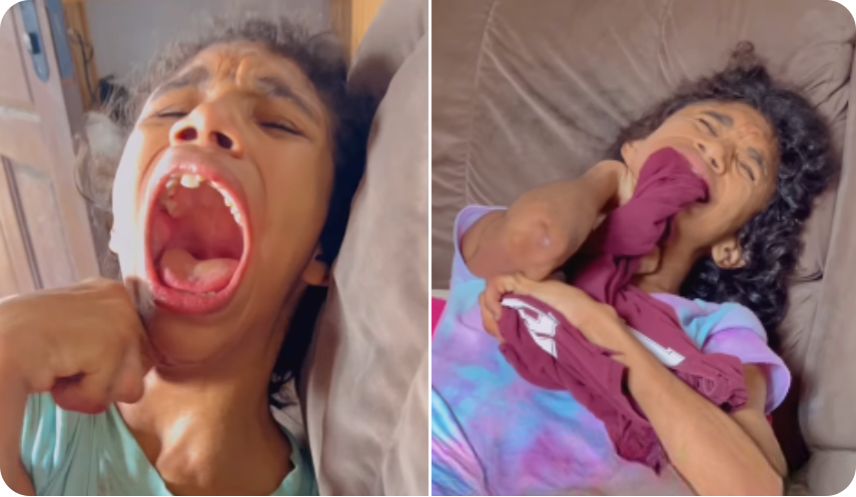 Vaquinha para cirurgia da Yasmin, que se morde e se machuca gravemente em crises intensas 24h por dia