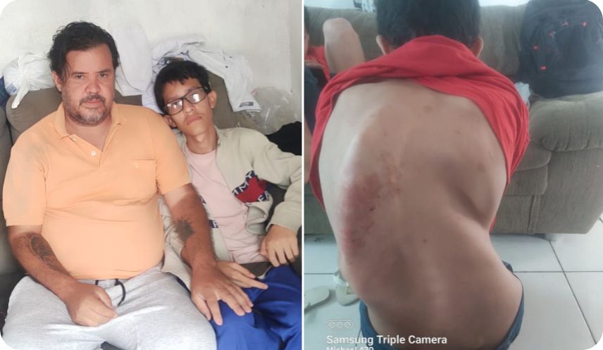 Pai cria filho sozinho e implora por tratamento do adolescente que não sai de casa devido a escoliose gravíssima