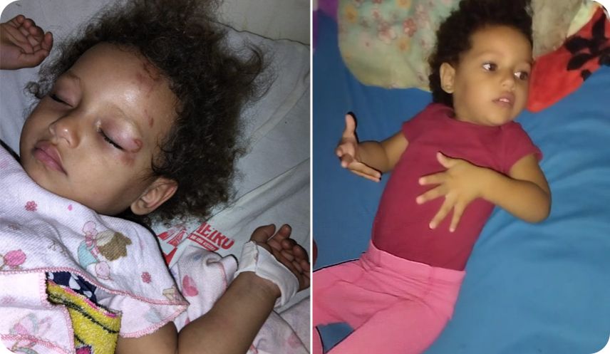 Vaquinha para tratamento da Bella, que tem de 10 a 13 crises epilépticas por dia (MA)