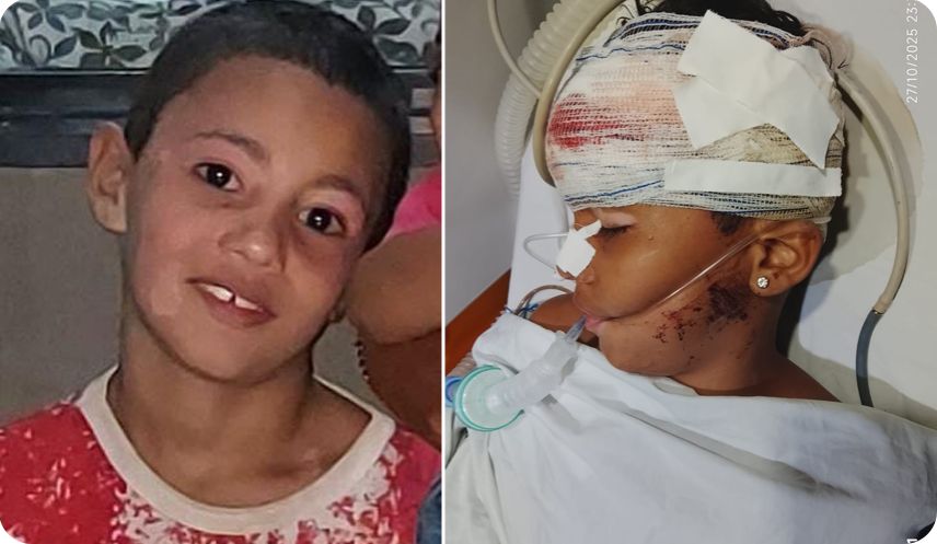 Criança de 11 anos é covardemente espancada à pauladas por 13 jovens! Ele saiu do coma e família pede ajuda.