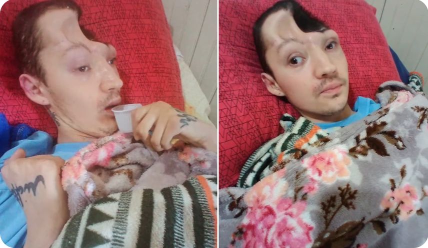 Vaquinha para o Winicius, que teve o crânio destruído em um grave acidente de carro