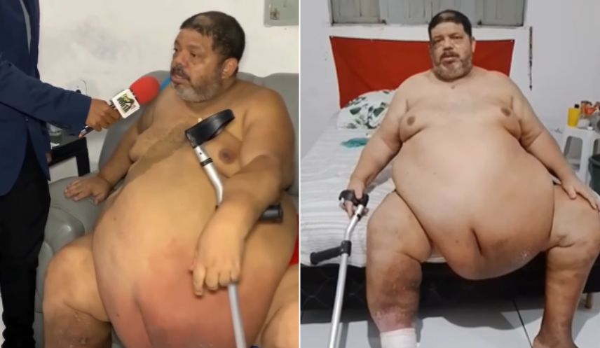 Após mãe morrer e esposa ir embora, Frank que pesa 214 kg luta por tratamento