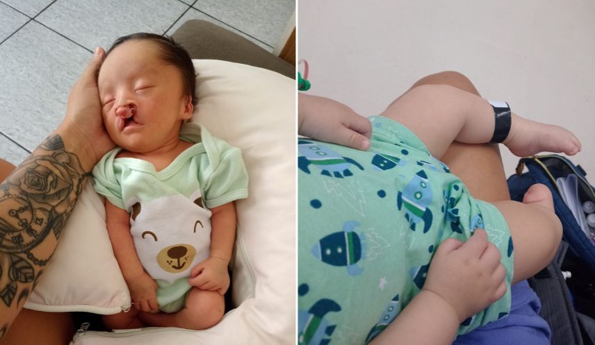 Bebê que nasceu com má formação, pode ficar sem andar após descaso do SUS