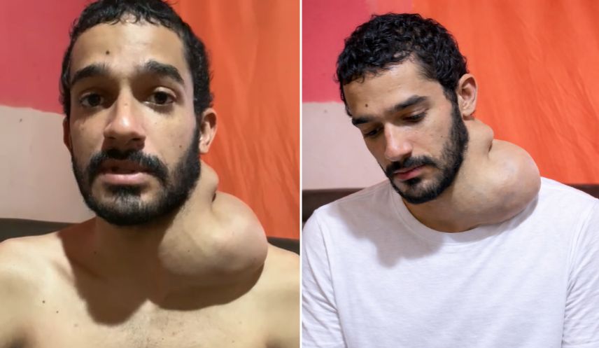 Com câncer avançado e sem conseguir comer nem respirar direito, jovem implora por ajuda para ter o básico: comida e moradia