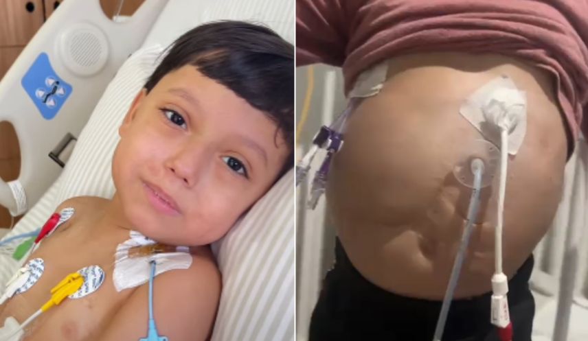 Desde o nascimento, com o intestino para fora do corpo, Benjamin vive no hospital e agora precisa de ajuda