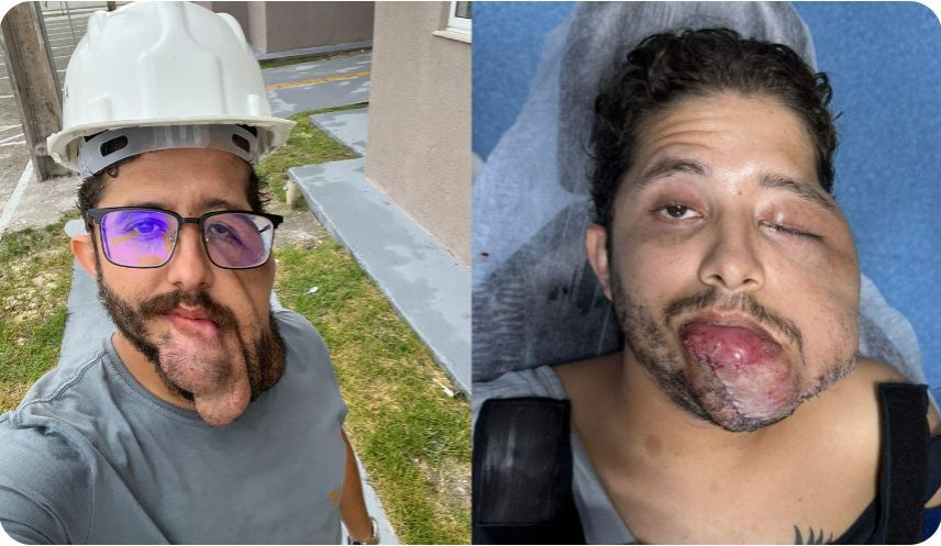 Vaquinha para ajudar maranhense com tumores que deformam o seu rosto. Sofre preconceito e comentários maldosos nas redes