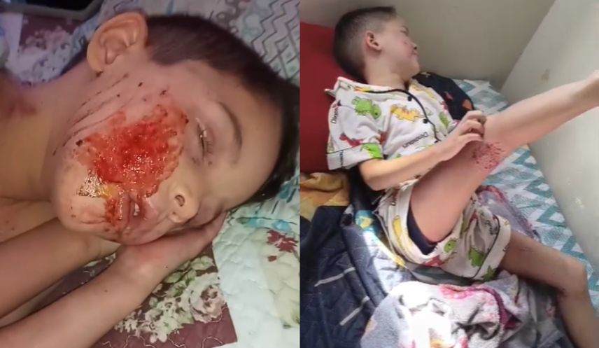 Vaquinha para o Luis, que se coça até sangrar, vive com a pele em carne viva e chega a pedir para morrer