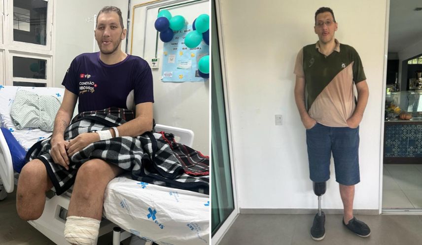 Homem mais alto do Brasil tem as duas pernas amputadas e faz apelo para conseguir próteses e voltar a andar
