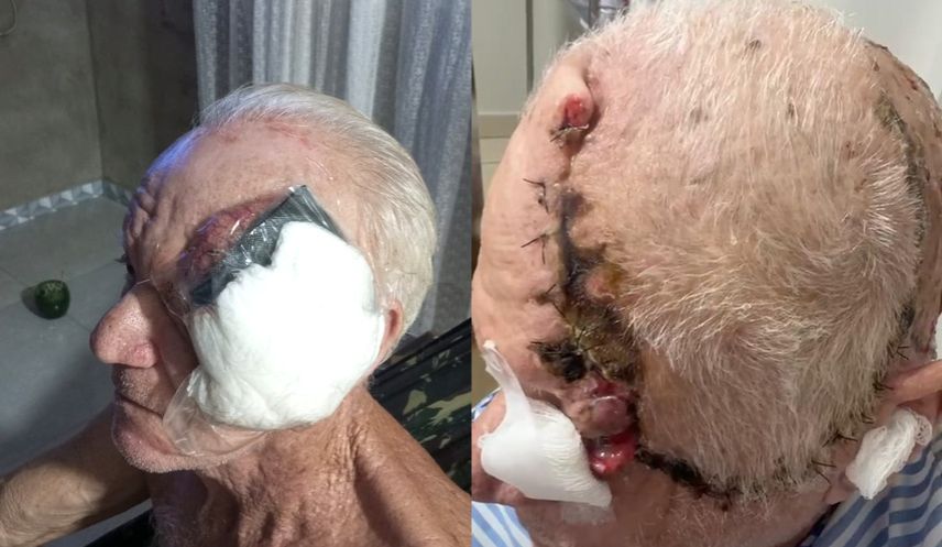 Depois de 17 anos longe da filha, Sr. Carlos reapareceu lutando contra um câncer agressivo