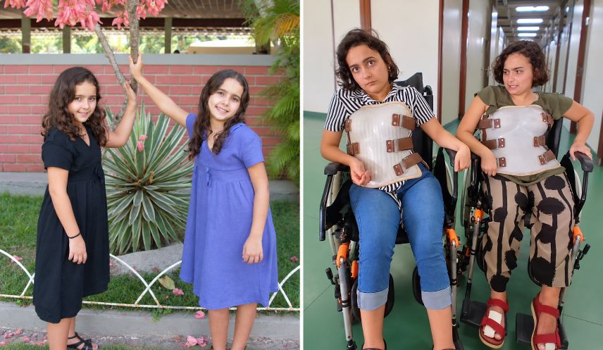 Gêmeas de 28 anos estão perdendo a visão e a fala para uma doença rara, e a mãe luta sozinha por um tratamento de quase R$ 500 mil